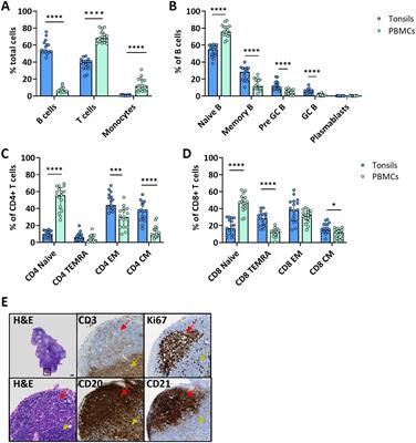 Tonsil explants as a human in vitro model to study vaccine responses